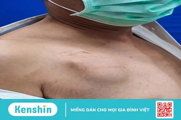 Máy tạo nhịp tim cho người già hoạt động ra sao? Lưu ý gì khi sử dụng?