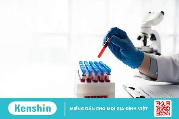 MCV trong xét nghiệm máu là gì và chỉ số bất thường cảnh báo điều gì?