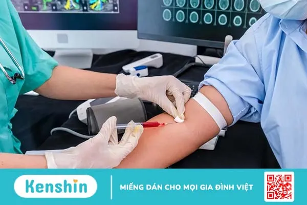 MCV trong xét nghiệm máu là gì và chỉ số bất thường cảnh báo điều gì?