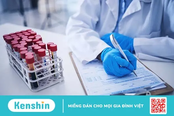 MCV trong xét nghiệm máu là gì và chỉ số bất thường cảnh báo điều gì?