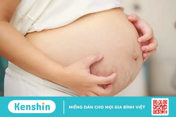 Mẹ bầu bị nổi mề đay khi mang thai: Nguyên nhân và cách chữa hiệu quả