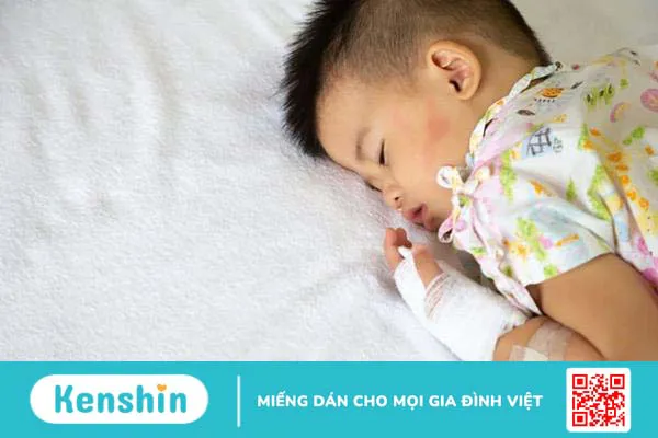 Mẹ đã biết vì sao trẻ bị sốt chân tay lạnh đầu nóng chưa?