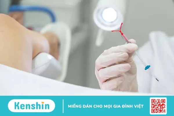 Mẹ sau sinh chưa có kinh nguyệt có đặt vòng được không?