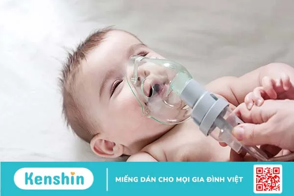 Mềm sụn thanh quản: Bệnh gây khò khè kéo dài ở trẻ