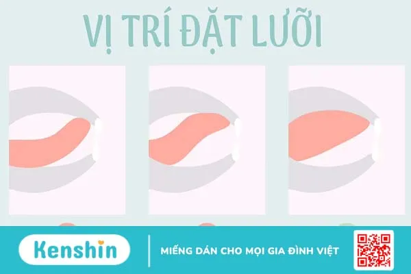 Mewing là gì? Phương pháp mewing có thật sự thần kỳ như lời đồn?