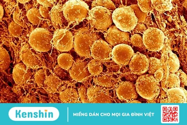 Mỡ nâu giúp bạn duy trì vóc dáng thon thả