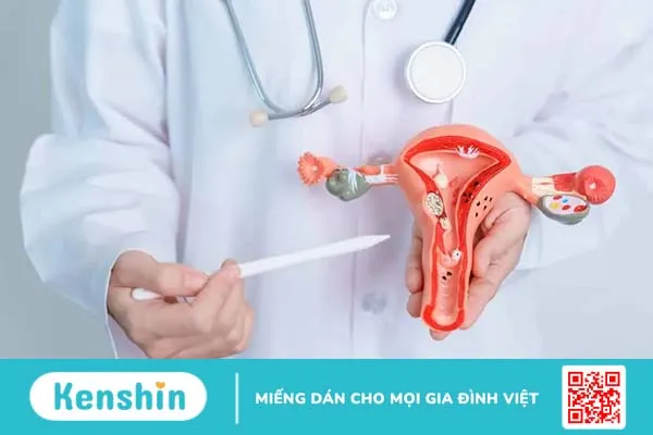 Mổ u xơ tử cung kiêng quan hệ bao lâu? Những lưu ý sau khi mổ u xơ tử cung