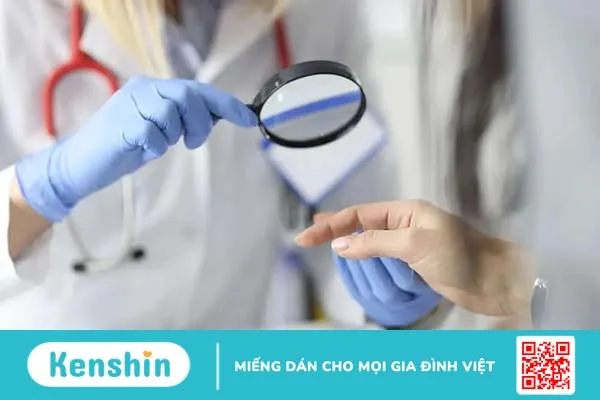 Móng tay bị rỗ là bệnh gì? Điều trị như thế nào hiệu quả?