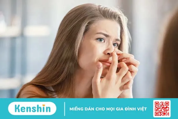 Mụn đầu đen ở mũi: Nguyên nhân và 7 cách trị mụn tại nhà