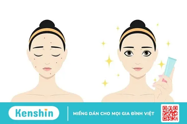 Mụn đỏ sưng tấy: Nguyên nhân và Cách điều trị dứt điểm