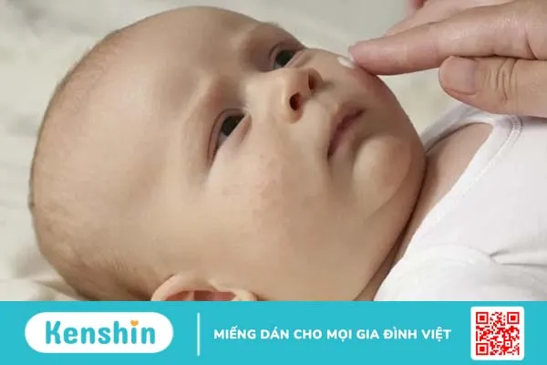 Mụn sữa ở trẻ sơ sinh có tự hết không? Cách trị mụn sữa hiệu quả