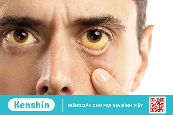 Muỗi đốt có thể gây ra những bệnh gì? Top 10 căn bệnh nguy hiểm nhất