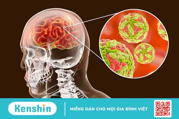 Muỗi đốt có thể gây ra những bệnh gì? Top 10 căn bệnh nguy hiểm nhất