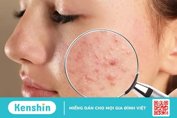 Muốn da khỏe mạnh: 5 điều nhất định phải biết