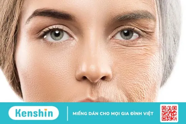 Muốn da khỏe mạnh: 5 điều nhất định phải biết