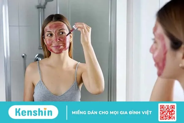 Nặn mụn xong nên làm gì để dưỡng da sáng, mịn, không sẹo thâm?