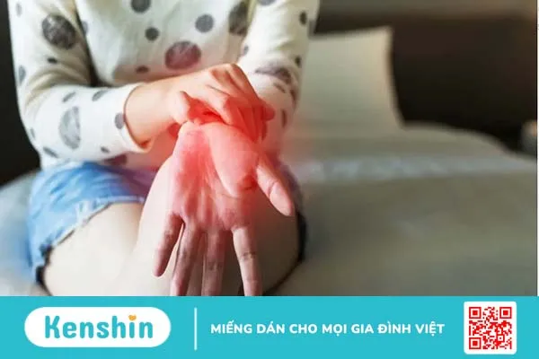 Ngứa lòng bàn tay là bệnh gì? Làm sao để điều trị?