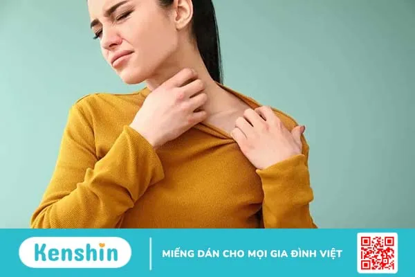 Ngứa nổi mề đay toàn thân: Nguyên nhân và cách điều trị