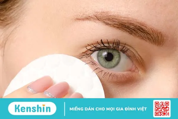 Người bị lẹo mắt kiêng gì để bệnh nhanh khỏi?