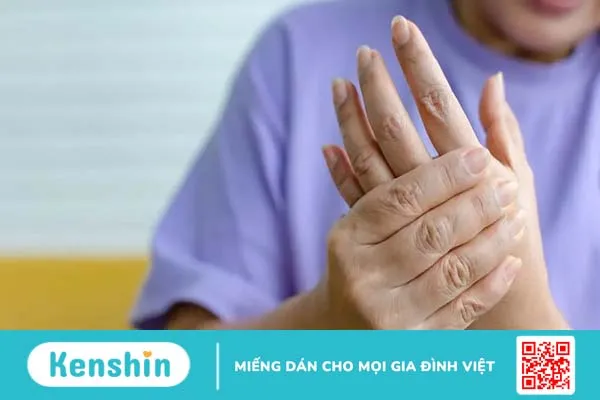 Người hay bị tê tay chân là thiếu chất gì?