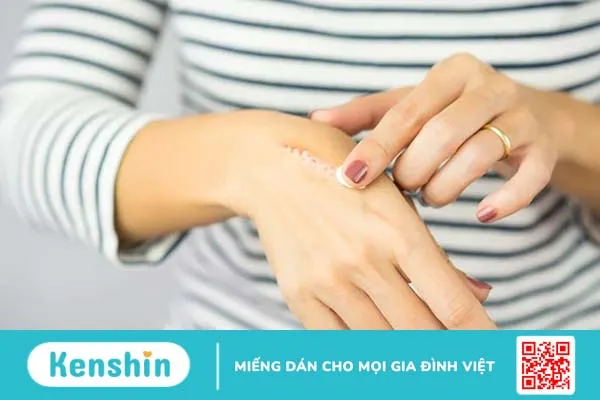 Người nhiễm HIV vết thương có lành không? Làm sao để biết mình có bị HIV không?