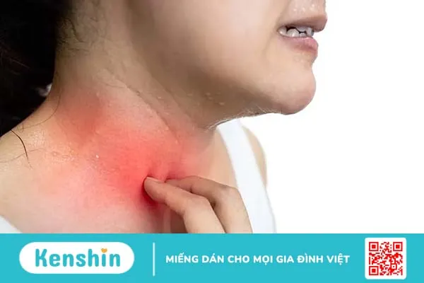 Nguyên nhân bị rôm sảy ở người lớn và cách điều trị hiệu quả