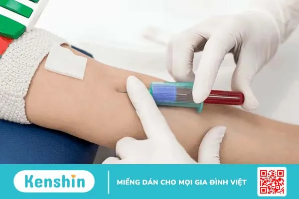 Nguyên nhân gây huyết áp thấp là gì? Điểm danh 12 thủ phạm điển hình