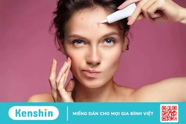 Nguyên nhân gây mụn ở từng vị trí và cách khắc phục