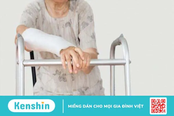 Nguyên nhân gãy xương là do đâu? Yếu tố nguy cơ và cách phòng ngừa