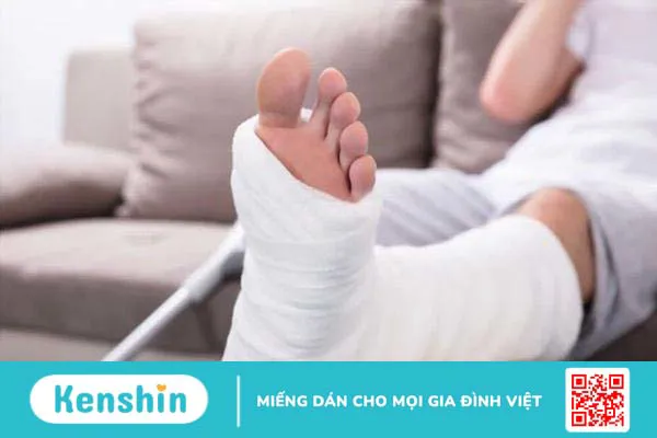 Nguyên nhân gãy xương là do đâu? Yếu tố nguy cơ và cách phòng ngừa