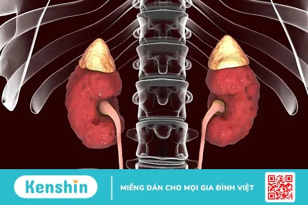 Nguyên nhân suy thận và bí quyết tránh nguy cơ chạy thận