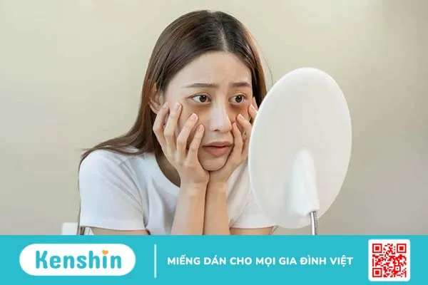 Nguyên nhân và cách hết quầng thâm mắt nhanh chóng