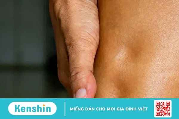 Nguyên nhân và cách khắc phục tình trạng phù chân ở người già