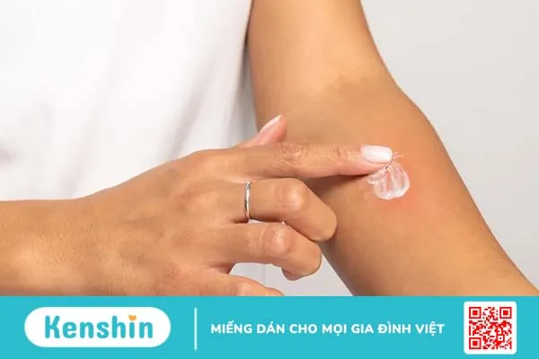 Nguyên nhân và những thông tin cần thiết về phát ban trên da