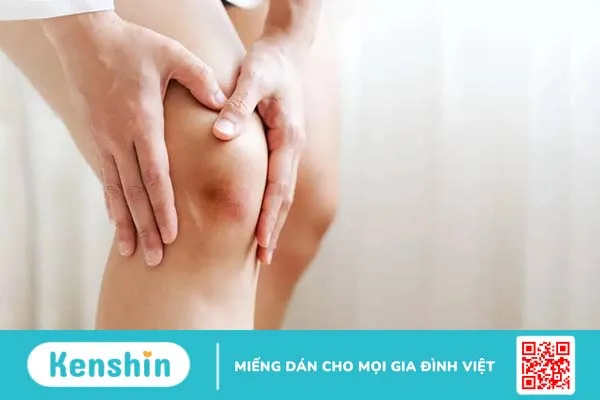 Nguyên nhân vỡ mạch máu dưới da là gì? Có nguy hiểm không?