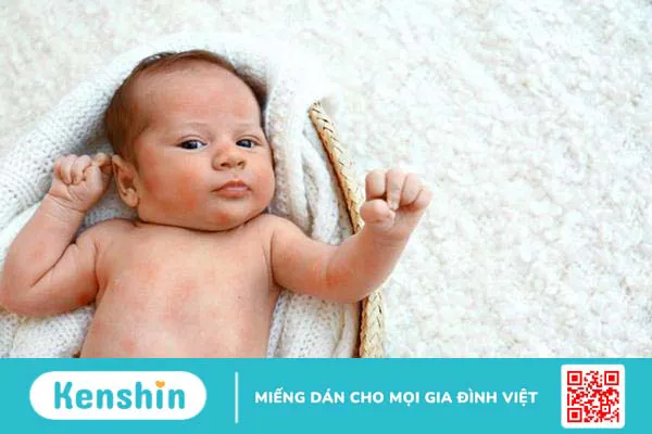 Nhận biết 10+ triệu chứng sốt siêu vi ở trẻ em phổ biến nhất