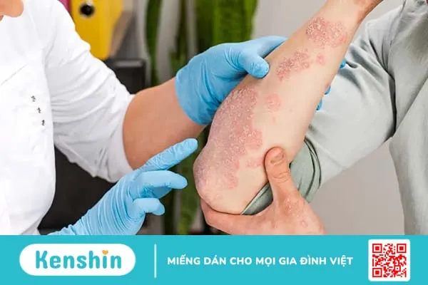 Nhận biết 7 dấu hiệu của bệnh tiểu đường không kiểm soát