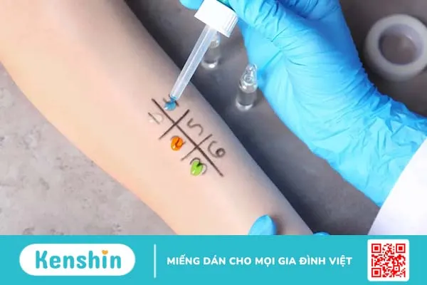 Nhận biết các dấu hiệu bị dị ứng da mặt và cách chăm sóc, điều trị đúng