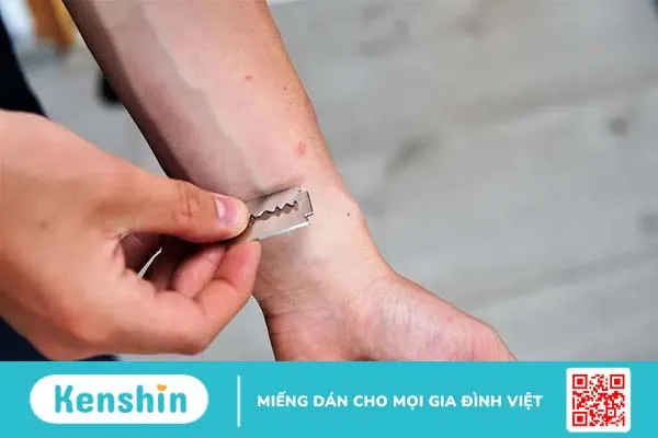 Nhận biết dấu hiệu trầm cảm nặng và nguy cơ tự sát