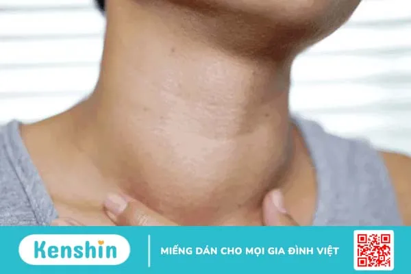 Nhận diện dấu hiệu ung thư tuyến giáp sớm để kịp thời chữa trị