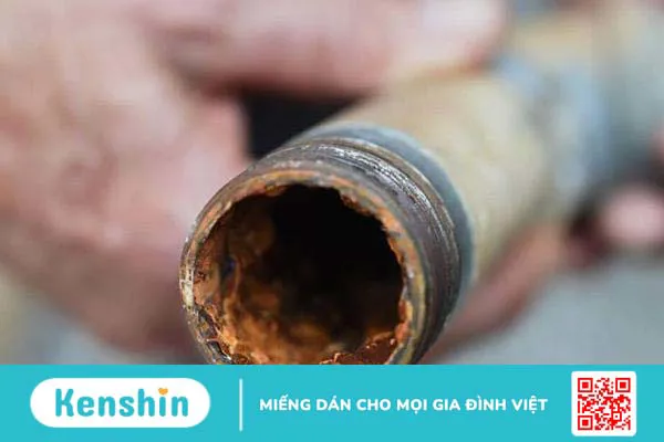 Nhiễm độc chì là gì, nhiễm chì nguy hiểm như thế nào?