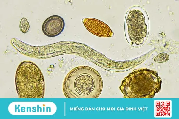 Nhiễm giun đũa: Nguyên nhân, triệu chứng, cách ngăn ngừa