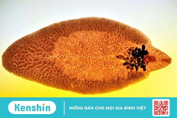 Nhiễm sán lá gan