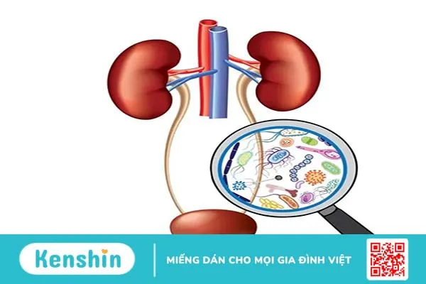 Nhiễm trùng đường tiết niệu (Viêm đường tiết niệu)