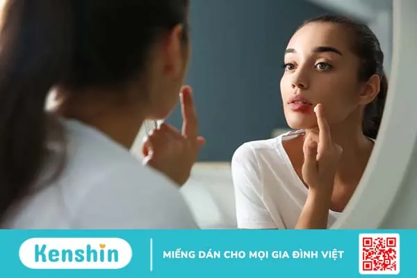 Nhiệt miệng lâu ngày không khỏi: Hiểu rõ nguyên nhân để điều trị hiệu quả