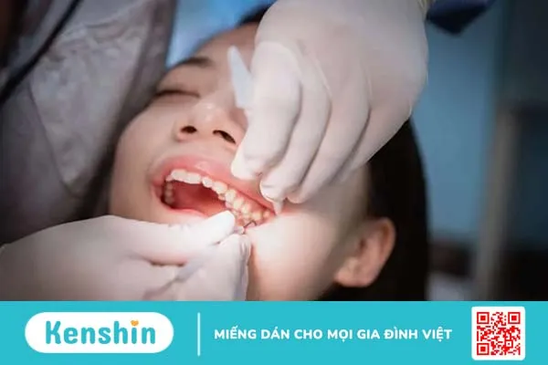 Nhổ răng khôn hàm trên có nguy hiểm hơn hàm dưới? Có nên nhổ không?