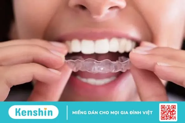 Những điều bạn nên biết về chứng ngủ nghiến răng