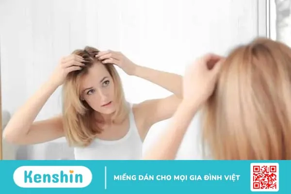 Những điều bạn nên biết về hội chứng nghiện bứt tóc