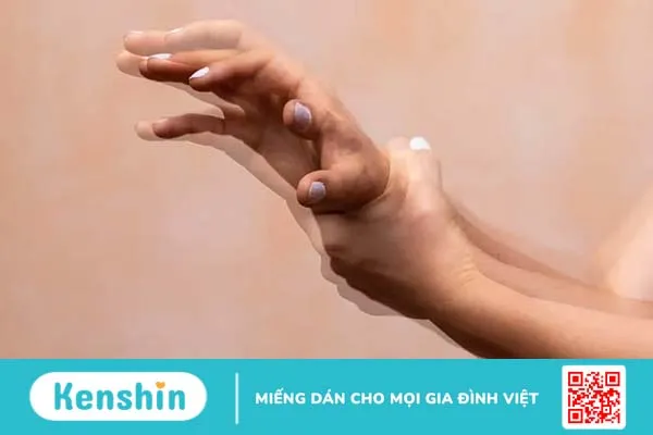 Những loại rối loạn vận động có thể bạn chưa biết