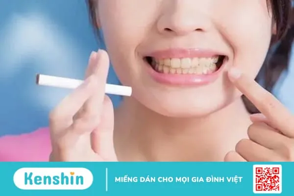 Những phương pháp tại nhà giúp làm trắng răng bị ố vàng